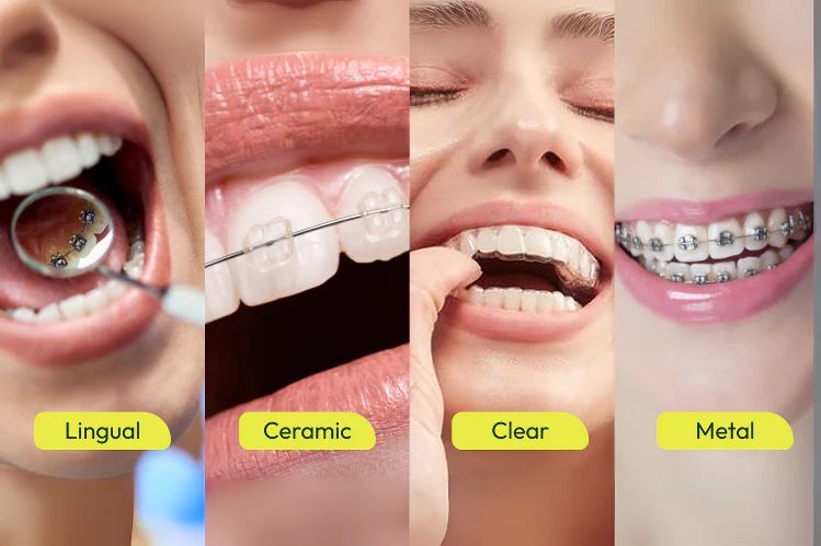 Orthodontics & Braces
