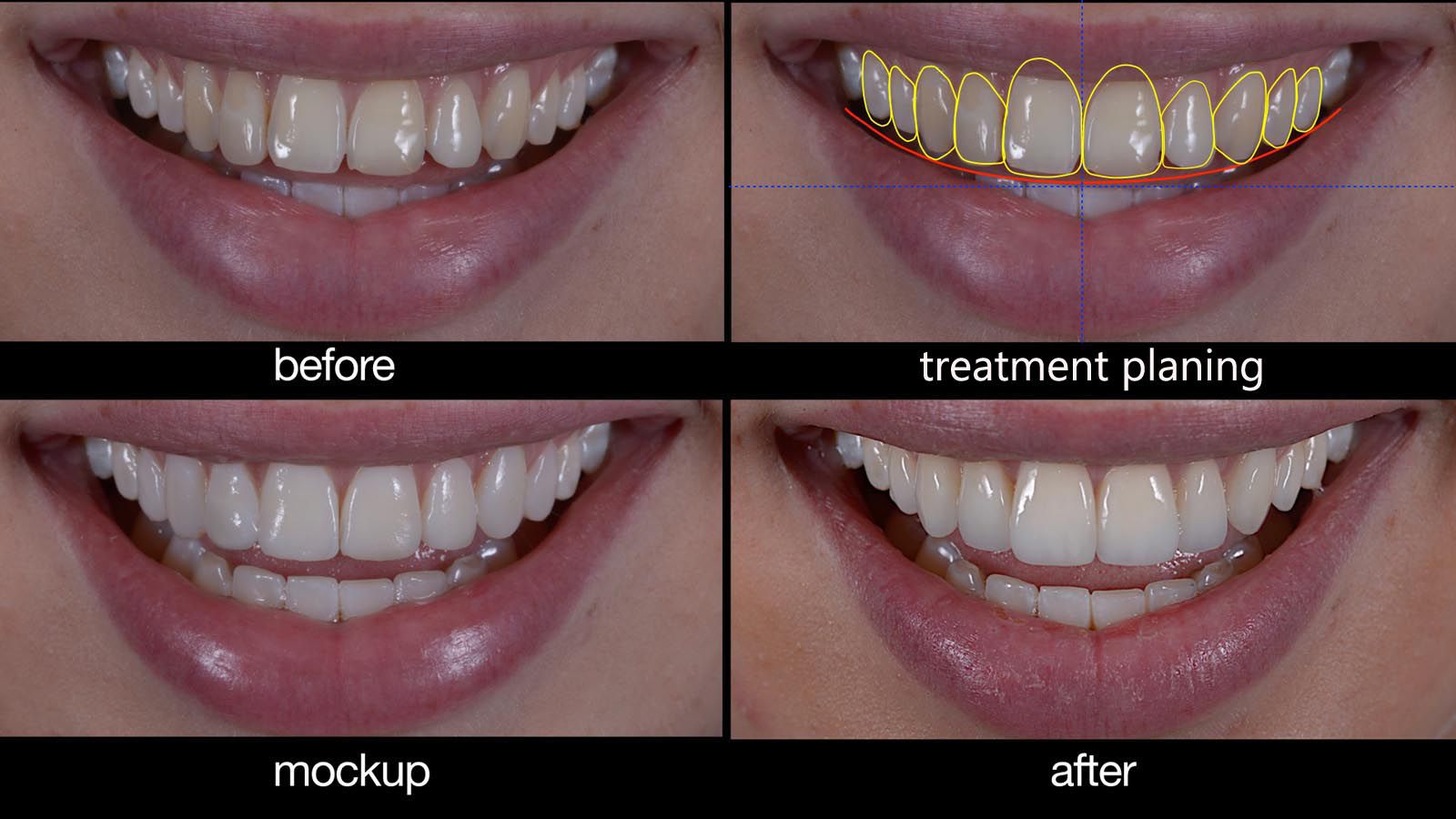 Cosmetic Dentistry