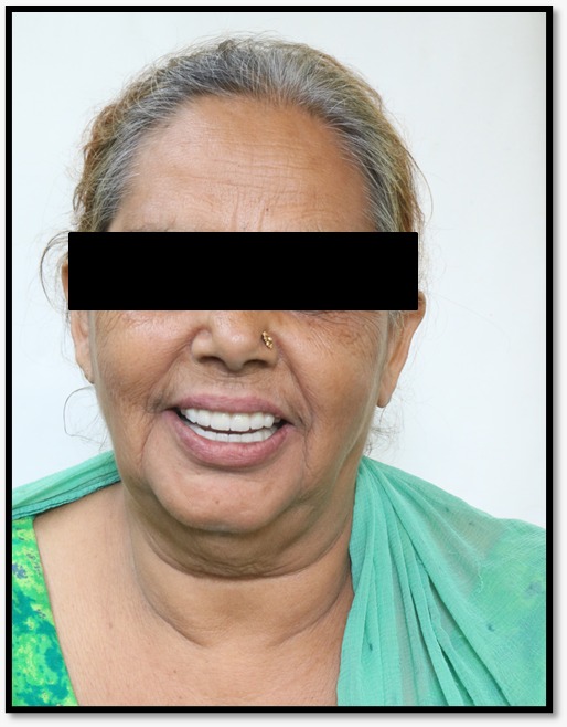 After Treatment