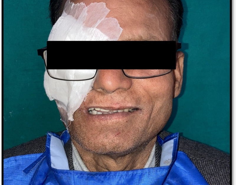 After Smile Makeover