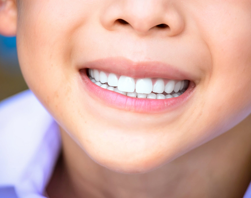 After Braces Treatment