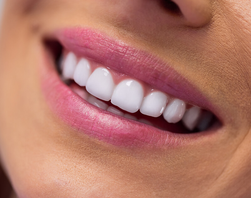 After Dental Care
