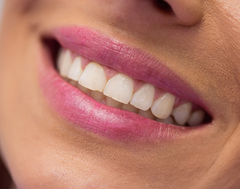 Before Dental Care